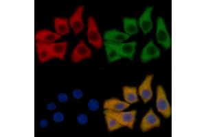 EPHB4 Mouse Monoclonal Antibody staining HepG2 cells by IF/ICC. (EPH Receptor B4 anticorps  (Internal Region))