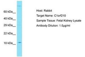 Image no. 1 for anti-Chromosome 1 Open Reading Frame 210 (C1ORF210) (AA 42-91) antibody (ABIN6750765) (C1ORF210 anticorps  (AA 42-91))