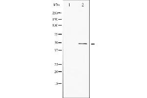 Western blot analysis of ATF2 phosphorylation expression in TNF-α treated HeLa whole cell lysates,The lane on the left is treated with the antigen-specific peptide.
