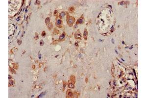 Immunohistochemistry of paraffin-embedded human placenta tissue using ABIN7163916 at dilution of 1:100 (KCNK1 anticorps  (AA 268-336))