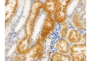 ABIN6263116 and ABIN6266862 at 1/100 staining human normal kidney tissue by IHC-P.