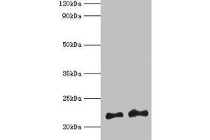 Western blot All lanes: Hras antibody at 2 μg/mL Lane 1: 293T whole cell lysate Lane 2: Mouse brain tissue Secondary Goat polyclonal to rabbit IgG at 1/10000 dilution Predicted band size: 22 kDa Observed band size: 22 kDa (HRAS anticorps  (AA 2-186))