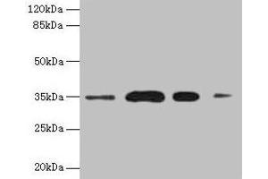 Western blot All lanes: SULT1A3 antibody at 20 μg/mL Lane 1: A549 whole cell lysate Lane 2: Colo320 whole cell lysate Lane 3: Mouse brain tissue Lane 4: Mouse kidney tissue Secondary Goat polyclonal to rabbit IgG at 1/10000 dilution Predicted band size: 35, 23 kDa Observed band size: 35 kDa (SULT1A3 anticorps  (AA 1-295))