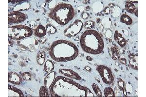 Image no. 3 for anti-Prefoldin Subunit 3 (PFDN3) antibody (ABIN1501706)