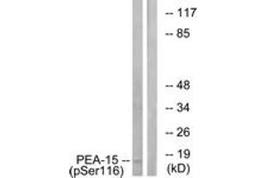 Western blot analysis of extracts from COS7 cells treated with INSULIN 0. (PEA15 anticorps  (pSer116))