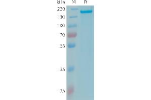 Human CFH Protein, His Tag on SDS-PAGE under reducing condition.