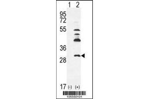 Western blot analysis of UCK2 using rabbit polyclonal hUCK2-C241 using 293 cell lysates (2 ug/lane) either nontransfected (Lane 1) or transiently transfected (Lane 2) with the UCK2 gene. (UCK2 anticorps  (C-Term))