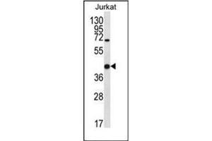 Western blot analysis of Galectin-4 Antibody (N-term) in Jurkat cell line lysates (35ug/lane). (GAL4 anticorps  (N-Term))