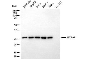 anti-UPF0568 Protein C14orf166 (RTRAF) antibody