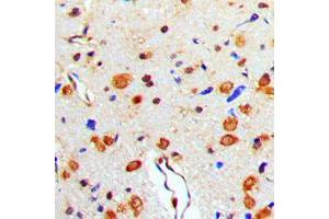 Immunohistochemical analysis of TAU (pT529) staining in human brain formalin fixed paraffin embedded tissue section.