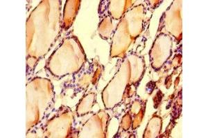 Immunohistochemistry of paraffin-embedded human thyroid tissue using ABIN7158488 at dilution of 1:100 (LONP1 anticorps  (AA 614-959))