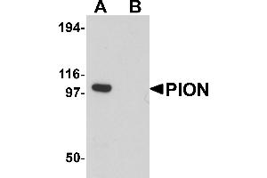 Western Blotting (WB) image for anti-Pigeon Homolog (PION) (C-Term) antibody (ABIN1030587) (GSAP anticorps  (C-Term))
