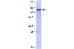 Image no. 1 for Thyroid Hormone Receptor, alpha (THRA) (AA 1-410) protein (GST tag) (ABIN1322716)
