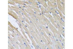 Immunohistochemistry of paraffin-embedded Rat heart using CRHBP Polyclonal Antibody at dilution of 1:100 (40x lens).