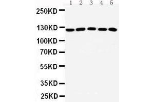 Western Blotting (WB) image for anti-Suppression of Tumorigenicity 5 (ST5) (AA 571-586), (Middle Region) antibody (ABIN3042548) (ST5 anticorps  (Middle Region))