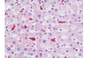 Anti-CD163 antibody IHC staining of human liver. (CD163 anticorps)