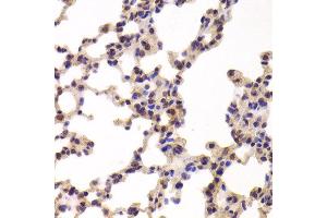 Immunohistochemistry of paraffin-embedded Mouse lung using PYGL antibody at dilution of 1:100 (x400 lens). (PYGL anticorps)