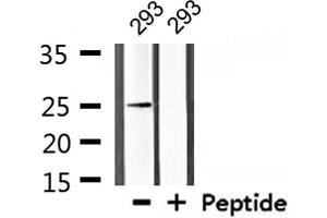 Western blot analysis of extracts from 293, using Claudin 10 Antibody. (CLDN10 anticorps  (C-Term))