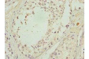 Immunohistochemistry of paraffin-embedded human testis tissue using ABIN7146346 at dilution of 1:100 (CALCOCO1 anticorps  (AA 462-691))