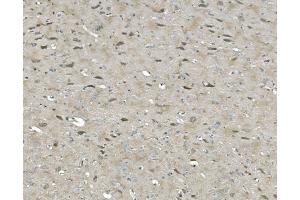 IHC analysis of ULK1 using anti-ULK1 antibody (ABIN7602755). (ULK1 anticorps  (C-Term))