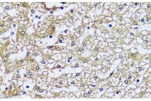 Immunohistochemistry of paraffin-embedded Human liver using NQO2 Polyclonal Antibody at dilution of 1:100 (40x lens).