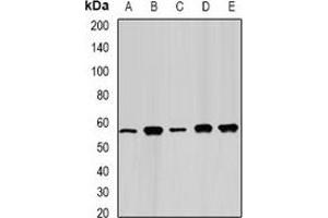 Western blot analysis of FAAH expression in Jurkat (A), Hela (B), mouse kidney (C), PC12 (D), COS7 (E) whole cell lysates. (FAAH anticorps)