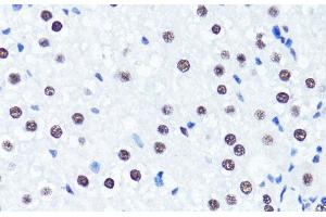 Immunohistochemistry of paraffin-embedded Rat liver using Symmetric DiMethyl-Histone H3-R2 Polyclonal Antibody at dilution of 1:100 (40x lens). (Histone 3 anticorps  (H3R2me2s))