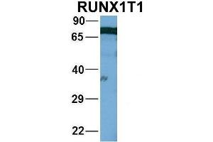 Host:  Rabbit  Target Name:  WT1  Sample Type:  721_B  Antibody Dilution:  1. (RUNX1T1 anticorps  (Middle Region))
