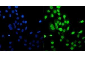 IF analysis of MCM5 using anti-MCM5 antibody (ABIN7600583). (MCM5 anticorps  (AA 206-723))