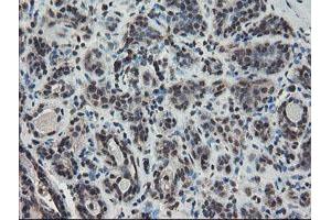 Immunohistochemical staining of paraffin-embedded Human breast tissue using anti-TDO2 mouse monoclonal antibody. (TDO2 anticorps)