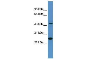 Tfdp1 antibody used at 0. (DP1 anticorps  (N-Term))