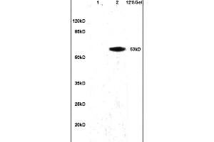 Lane 1: mouse brain lysates Lane 2: human colon carcinoma lysates probed with Anti alpha Actinin PGRN/Granulin Polyclonal Antibody, Unconjugated (ABIN728668) at 1:200 in 4 °C. (Granulin anticorps  (AA 451-550))