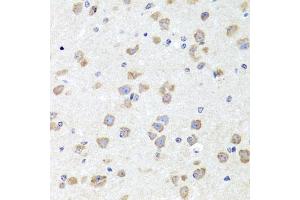 Immunohistochemistry of paraffin-embedded mouse brain using CHD1 antibody (ABIN5975217) at dilution of 1/100 (40x lens). (CHD1 anticorps)