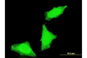 Immunofluorescence of monoclonal antibody to PPP1R2P3 on HeLa cell. (PPP1R2P3 anticorps  (AA 1-205))