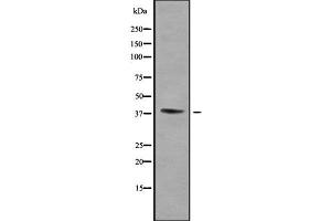 Western blot analysis of WNT16 using Jurkat whole cell lysates (WNT16 anticorps  (C-Term))