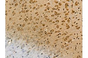 ABIN7094432 and ABIN7098480 at 1/100 staining Rat brain tissue by IHC-P. (ALDH1L1 anticorps  (C-Term))