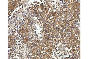 IHC analysis of CBR1 using anti-CBR1 antibody (ABIN7600015). (CBR1 anticorps  (AA 14-262))