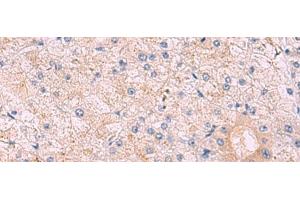 Immunohistochemistry of paraffin-embedded Human tonsil tissue using KANSL1L Polyclonal Antibody at dilution of 1:40(x200) (KANSL1L anticorps)