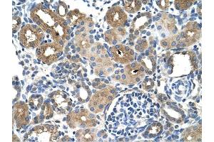 DCXR antibody was used for immunohistochemistry at a concentration of 4-8 ug/ml to stain Epithelial cells of renal tubule (arrows) in Human Kidney. (DCXR anticorps  (Middle Region))