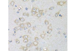 Immunohistochemistry of paraffin-embedded Rat brain using CHMP1B Polyclonal Antibody at dilution of 1:100 (40x lens). (CHMP1B anticorps)