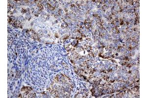 Image no. 1 for anti-NADH Dehydrogenase (Ubiquinone) 1 beta Subcomplex, 10, 22kDa (NDUFB10) antibody (ABIN1499672) (NDUFB10 anticorps)