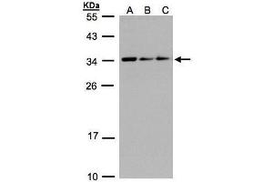WB Image Sample(30 ug whole cell lysate) A:293T B:A431, C:H1299 12% SDS PAGE antibody diluted at 1:1000 (SARNP anticorps)