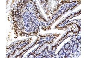 IHC analysis of HNF-4-alpha using anti-HNF-4-alpha antibody (ABIN7600215).