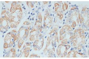 Immunohistochemistry of paraffin-embedded Human stomach using ADAM9 Polyclonal Antibody at dilution of 1:100 (40x lens). (ADAM9 anticorps)