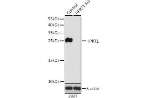 Western blot analysis of extracts from normal (control) and HPRT1 knockout (KO) 293T cells, using HPRT1 antibody (ABIN6132283, ABIN6141970, ABIN6141971 and ABIN7101782) at 1:1000 dilution. (HPRT1 anticorps  (AA 1-218))