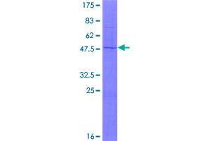 Image no. 1 for Mitochondrial Ribosomal Protein L11 (MRPL11) (AA 1-192) protein (GST tag) (ABIN1311288)