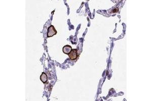 Immunohistochemical staining (Formalin-fixed paraffin-embedded sections) of human lung with SPN polyclonal antibody  shows strong membranous positivity in a subset of macrophages and pneumocytes. (CD43 anticorps  (AA 315-394))