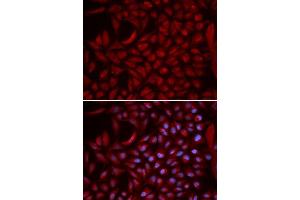 Immunofluorescence analysis of U2OS cells using CUL5 antibody.