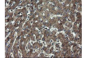 Immunohistochemical staining of paraffin-embedded Human liver tissue using anti-DOK7 mouse monoclonal antibody. (DOK7 anticorps)