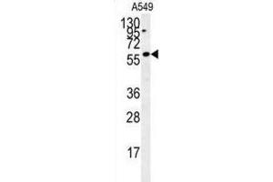 Western Blotting (WB) image for anti-PARP1 Binding Protein (PARPBP) antibody (ABIN2995516)